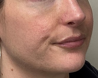 Close-up of a person with light hair.