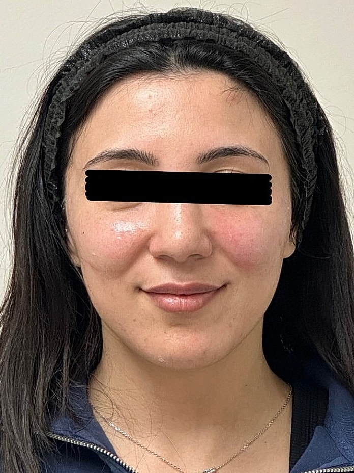 Young woman with long dark hair and headband.